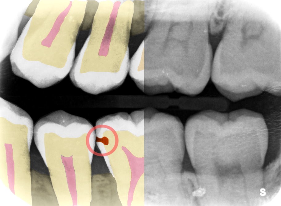 Y Combinator-backed Adra wishes to turn all dentists into cavity-finding ‘incredibly dental professionals’